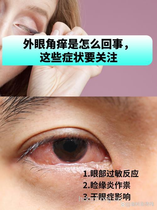 眼皮发痒多是为何？