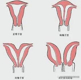哪两种女性最容易生畸形儿?