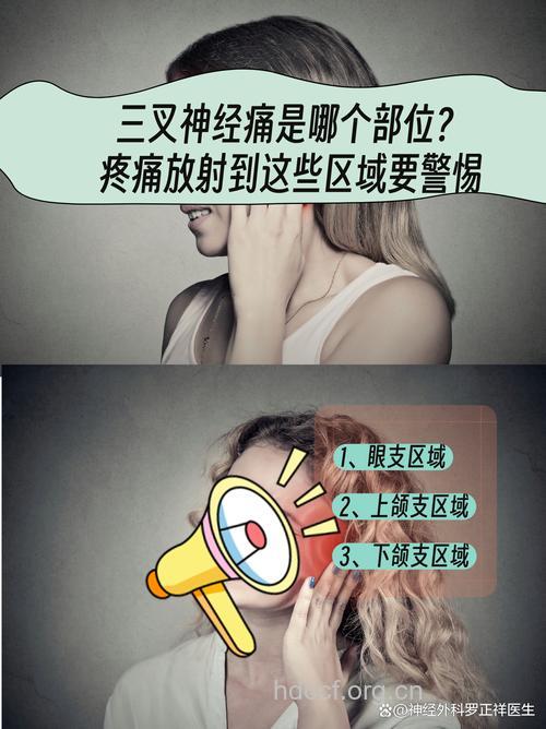 天凉 女性要防三叉神经痛