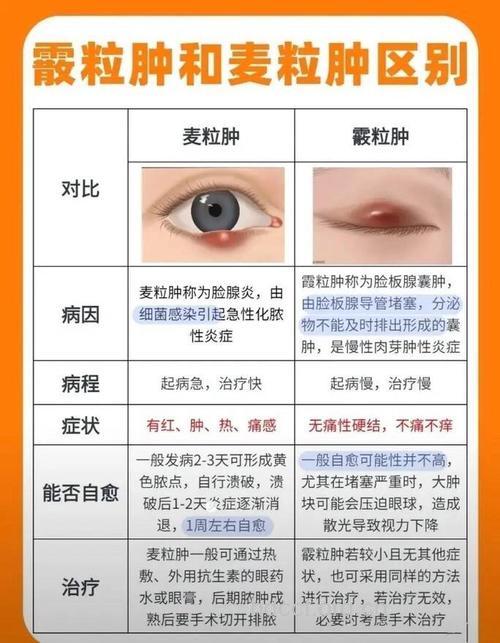 麦粒肿与散粒肿的防治