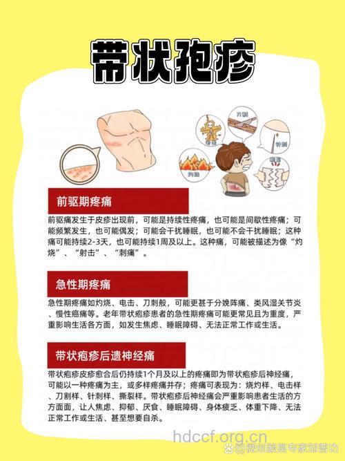 带状疱疹是否会传染和复发