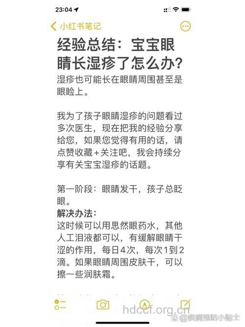 眼睑湿疹的治疗方法
