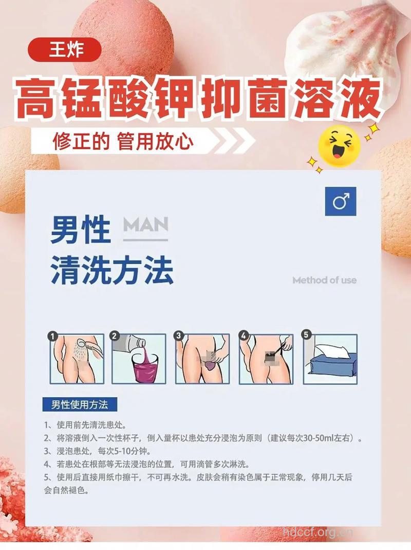 高锰酸钾洗液无预防性病作用
