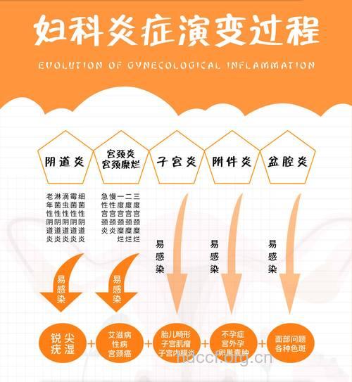 外阴阴道性不孕的种类有哪些 有哪些症状表现