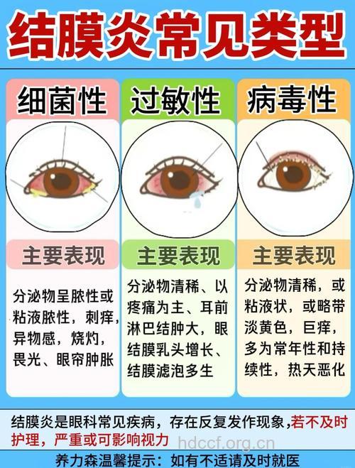 红眼病知识三问三答