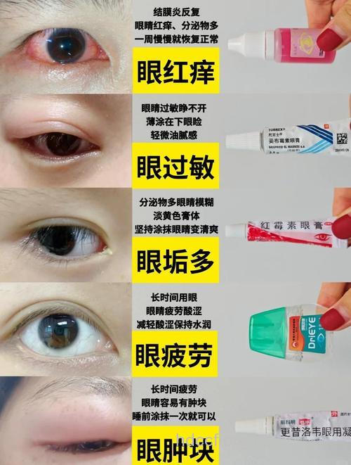 红眼病药水 不要能滴就滴