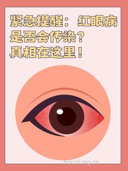 患红眼病，别急着打针