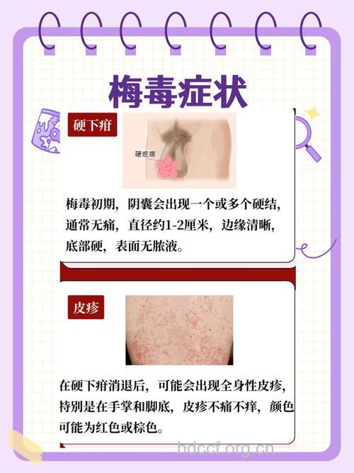 性病的发作期限一般为多久