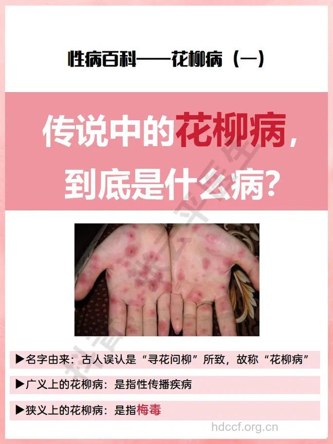 花柳病究竟该如何治疗