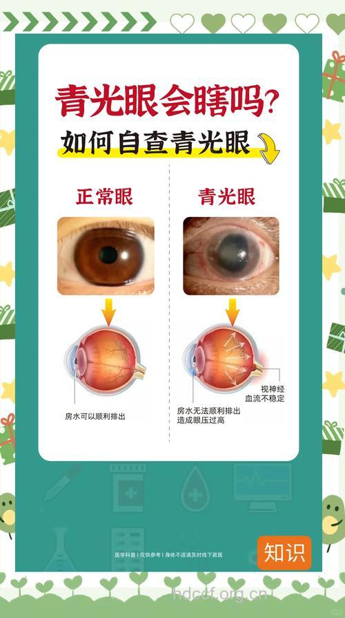 过早绝经易得青光眼