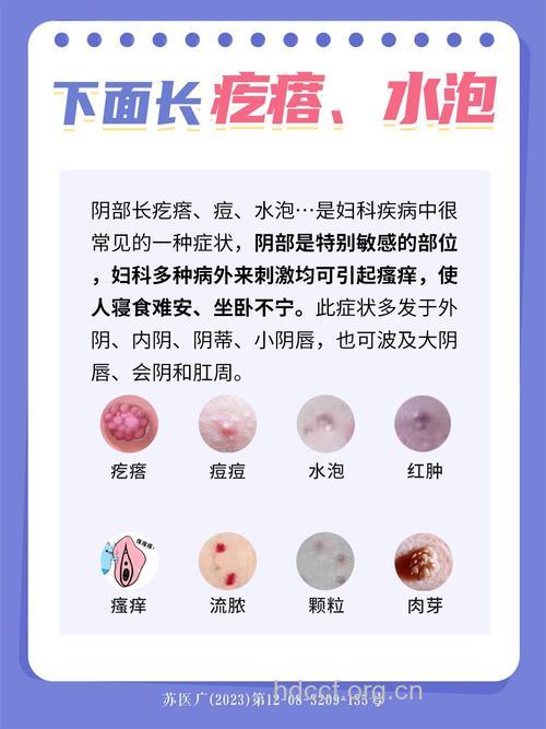 辨别阴部小疙瘩是不是性病