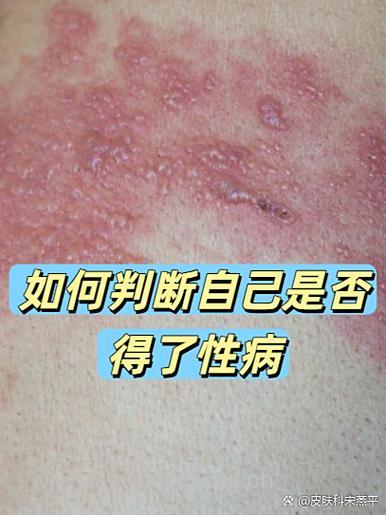 性病患者可以生健康宝宝吗