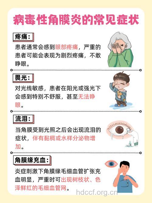 怎么应对病毒性角膜炎