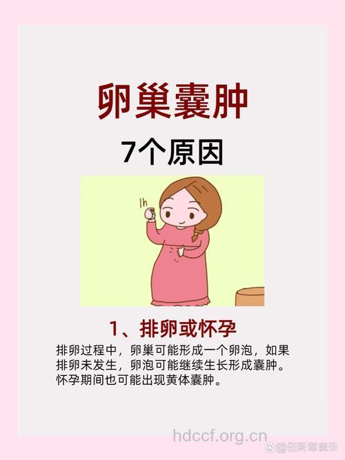 女性卵巢囊肿的三大因素