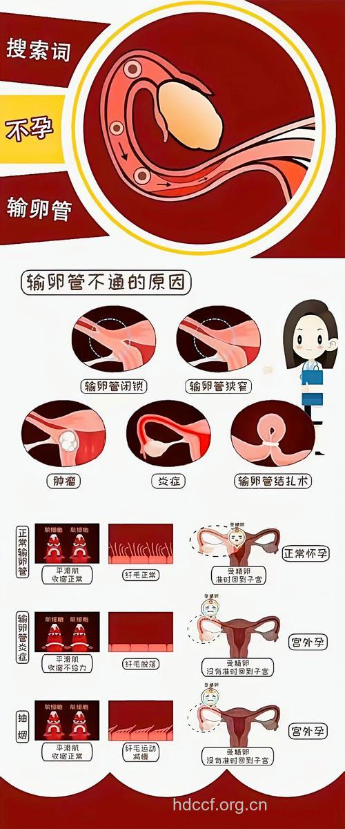 输卵管不孕的症状有哪些?要如何预防
