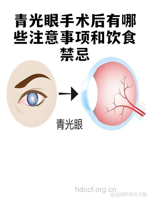 青光眼术后不宜大补