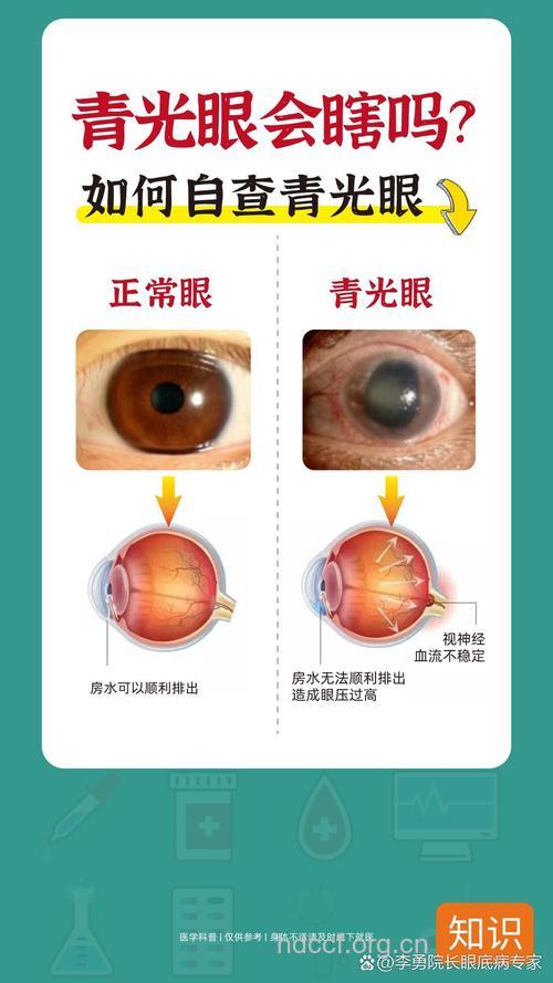 是否可根治青光眼