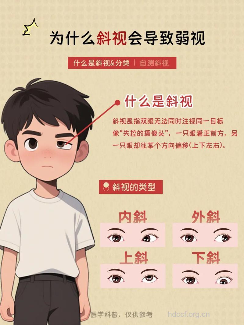 斜视性弱视是怎么回事呢