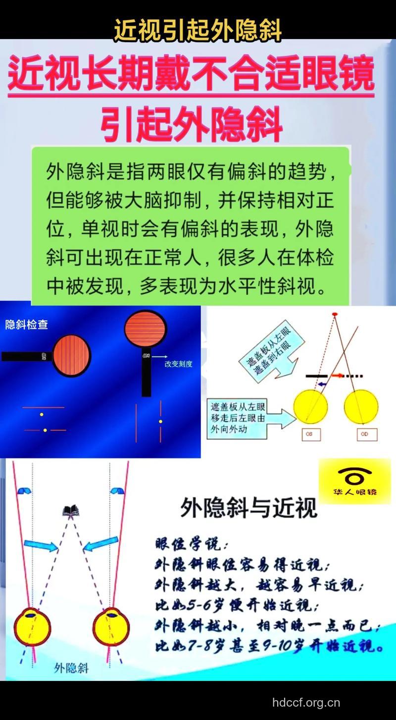 怎么佩戴眼镜会导致斜视