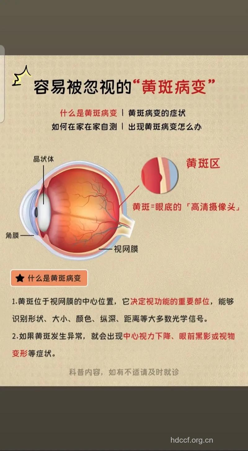 怎么应对视网膜黄斑变性
