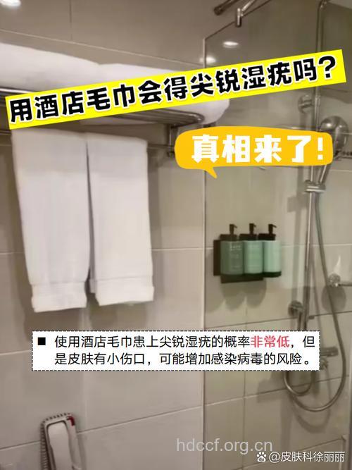 酒店的毛巾会传播尖锐湿疣吗