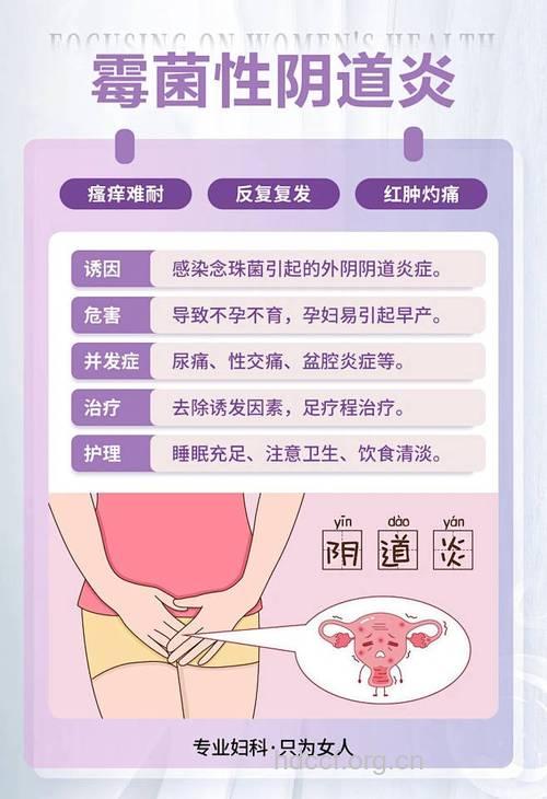 防治阴道炎的几种方法