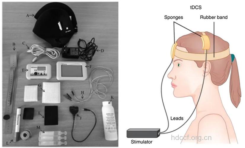 抑郁症新疗法：脑内电刺激
