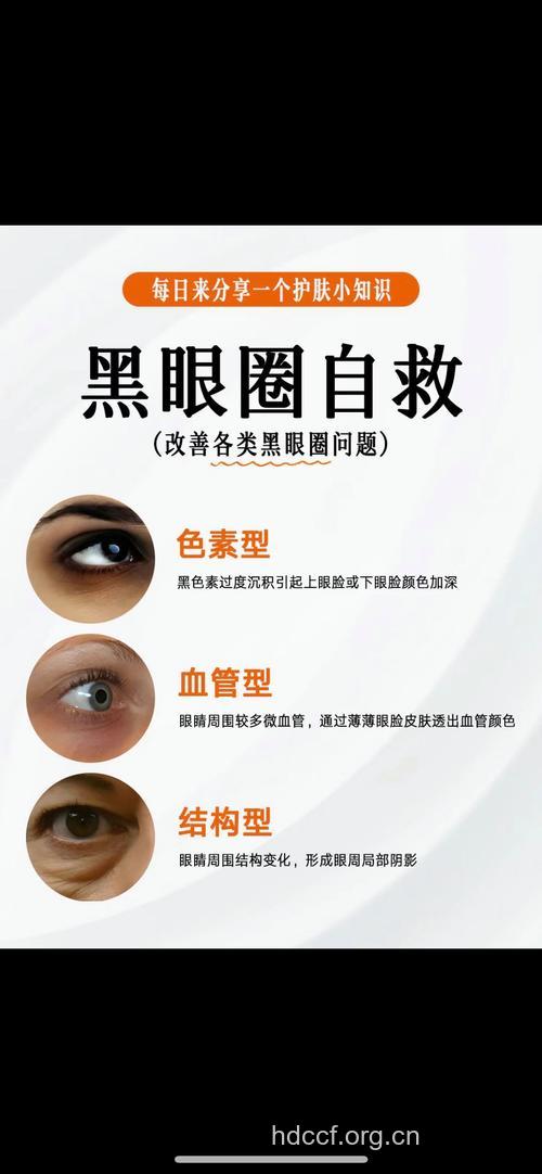 为何会出现黑眼圈 中医分析黑眼圈的病机