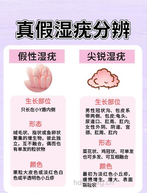 尖锐湿疣常见的诊断要点