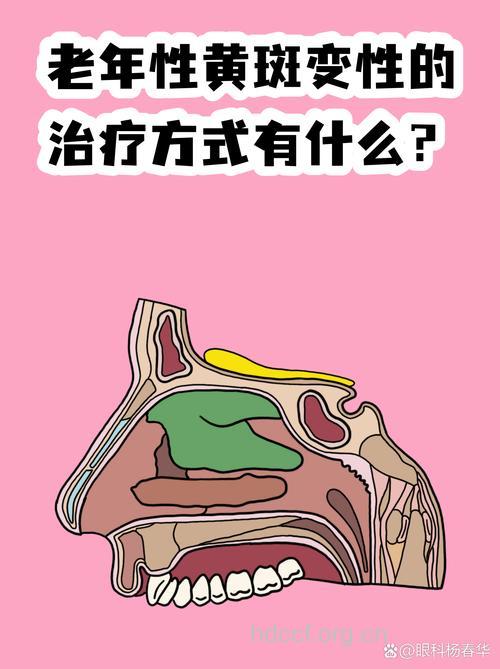 六款食疗方法缓解老年性黄斑变性病症