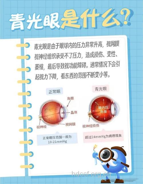 青光眼最佳的预防方法