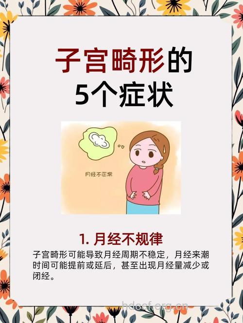 子宫发育不良的症状表现