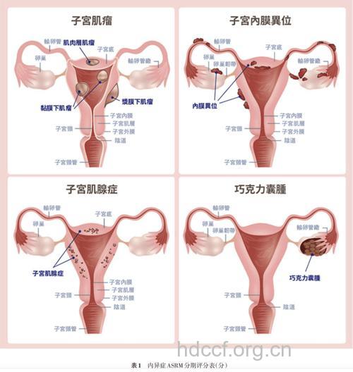不孕和哪些器官有关