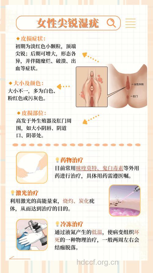 女性尖锐湿疣的症状表现