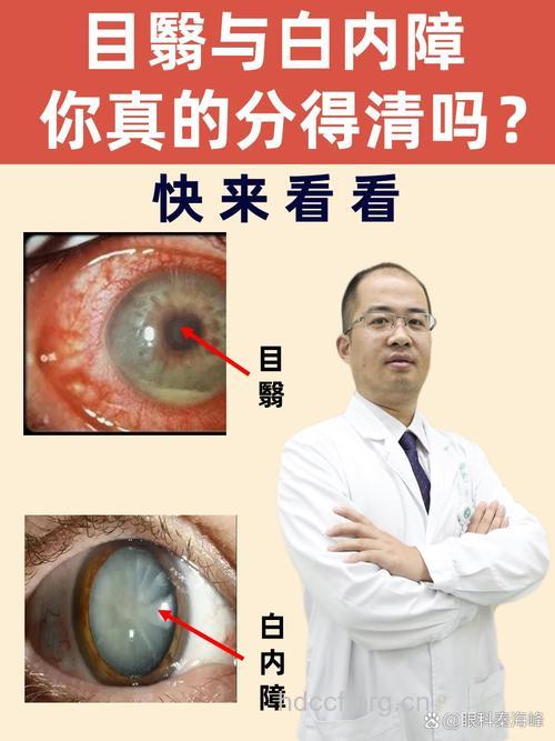 白内障易与什么疾病混淆