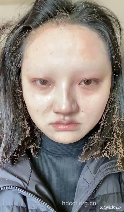 美眉化浓妆会导致沙眼吗
