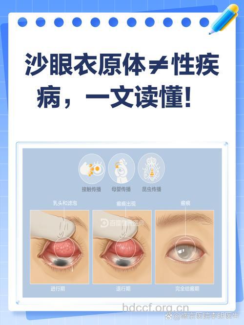 沙眼衣原体的病因是什么