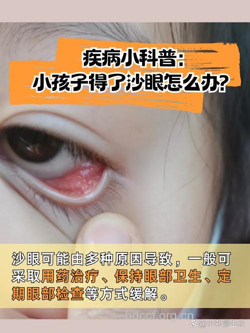 新生儿沙眼怎么防治