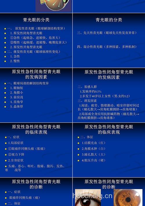 急性闭角性青光眼病因是什么