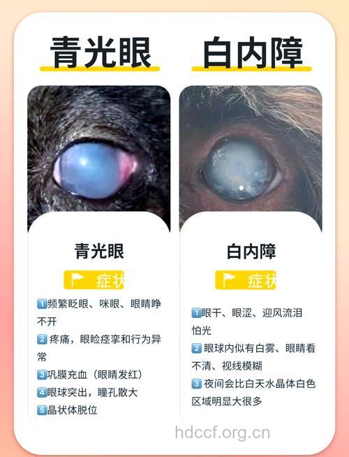 白内障可引发青光眼