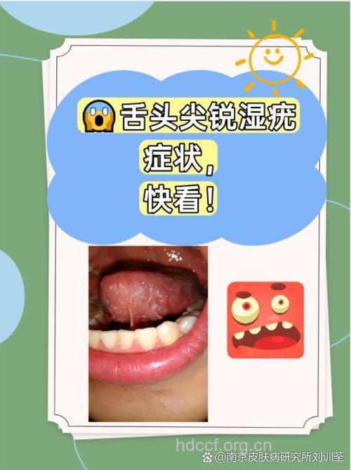 接吻是否会导致尖锐湿疣