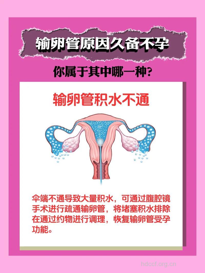 输卵管因素会造成女性不孕吗