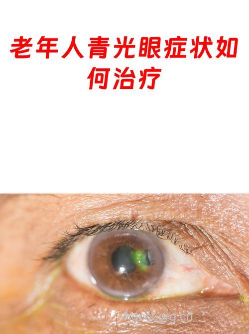 老人长时间打麻会致青光眼吗