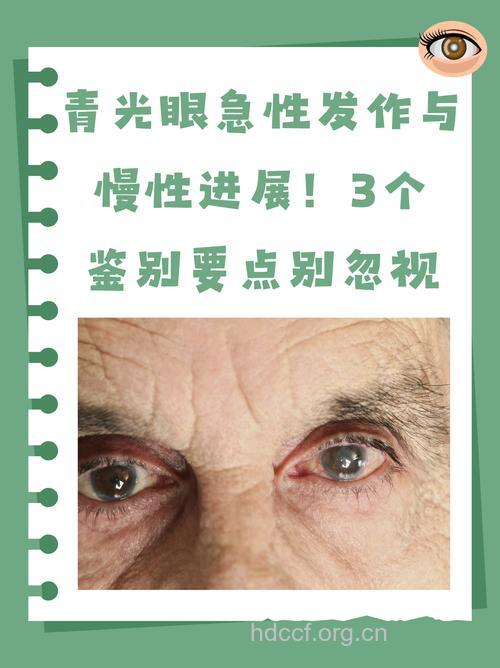 情绪波动大易得青光眼吗