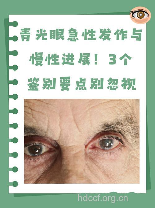 气温降幅过大小心诱发青光眼