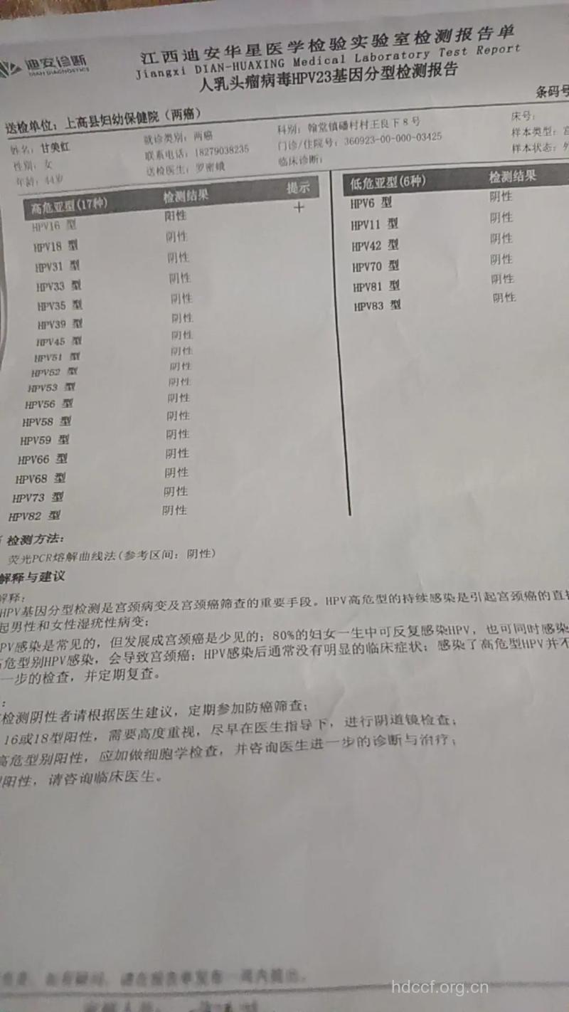 确诊尖锐湿疣需要做的检查