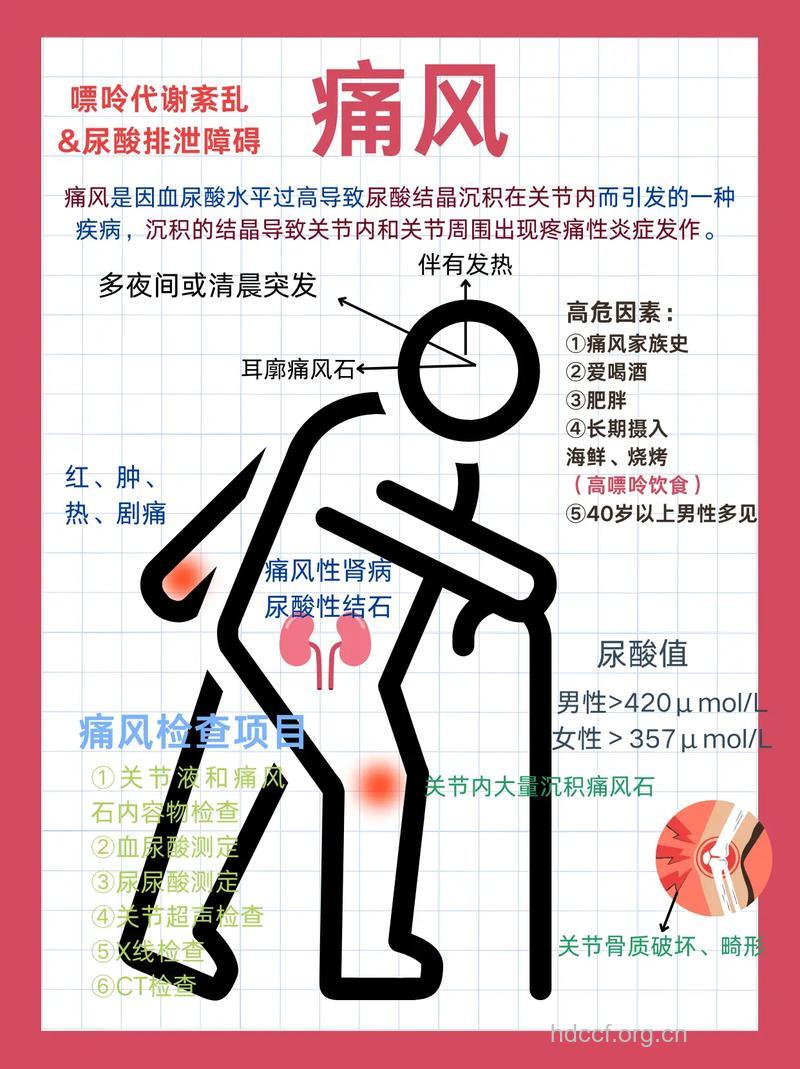 注意!老年女性也需要预防痛风