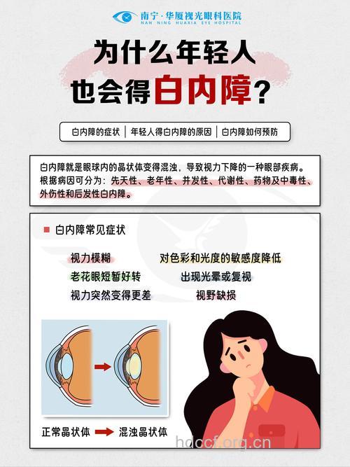 维他命能预防白内障吗
