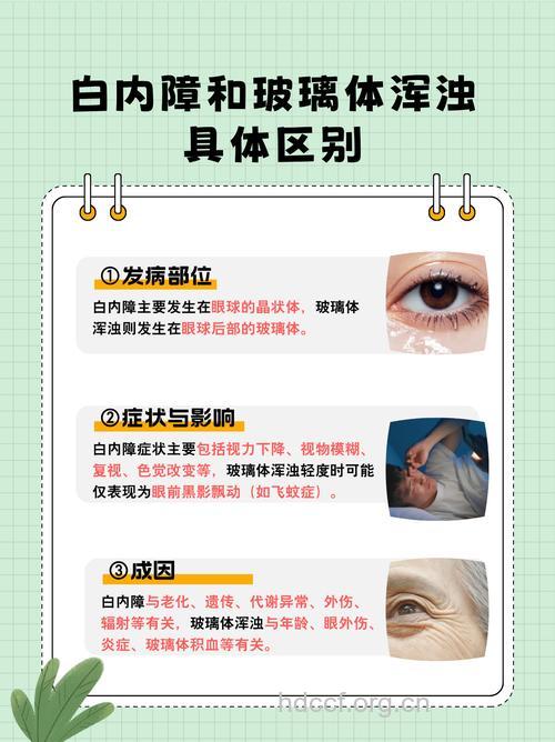 玻璃体混浊会导致白内障吗