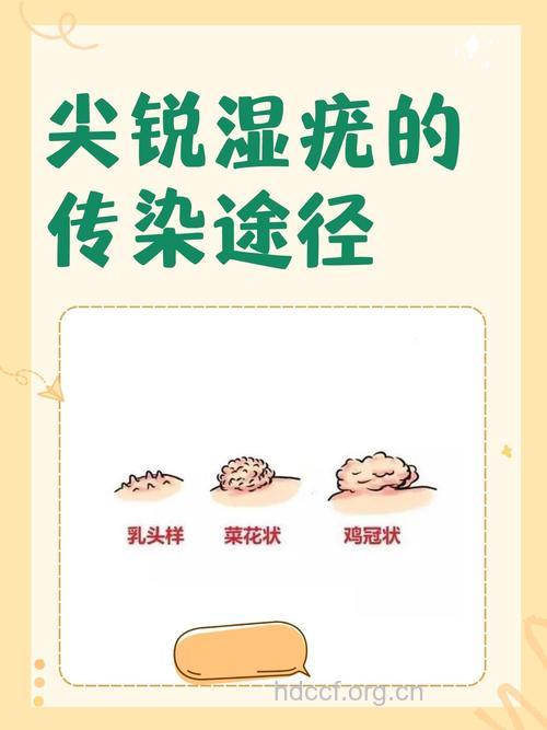 尖锐湿疣可以通过皮损传染吗